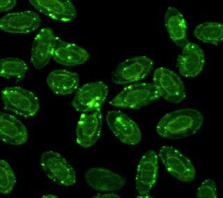 Virus ARN en acuicultura: bioseguridad y nuevas vacunas 1 Células rojas del Salmón con virus ISA