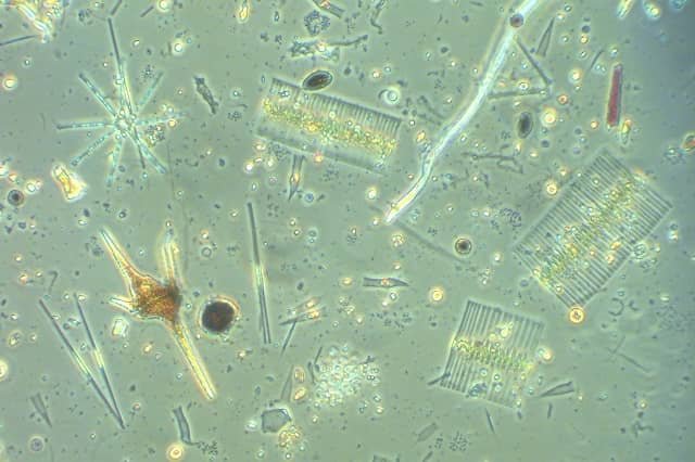 Aprende a comunicarte con las algas 1 Una mirada a través del microscopio de la diversa comunidad de microalgas de un lago de agua dulce, que incluye diatomeas, algas verdes y dinoflagelados/criosfitos. Foto: Maria Stockenreiter /LMU München