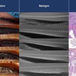 Diagnóstico de nefrocalcinosis en la piscicultura del salmón Diagnóstico de nefrocalcinosis en la piscicultura del salmón