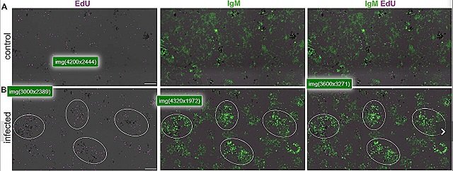 Tras la infección, se produce una intensa proliferación de células B IgM+ cerca de los centros de melanomacrofagos esplénicos (MMC). (A y B) Análisis de inmunofluorescencia de la incorporación de EdU por células de bazo de peces control (A) o infectados (B). Las criosecciones de bazo se tiñeron para EdU (magenta) e IgM (verde). Los grupos de celdas oscuras en todas las imágenes representan MMC. Los círculos blancos en (B) describen áreas adyacentes a MMC con alta proliferación celular. Crédito: Yasuhiro et al., Science Immunology (2023). DOI: 10.1126/sciimmunol.adf1627