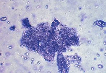 Biofloc